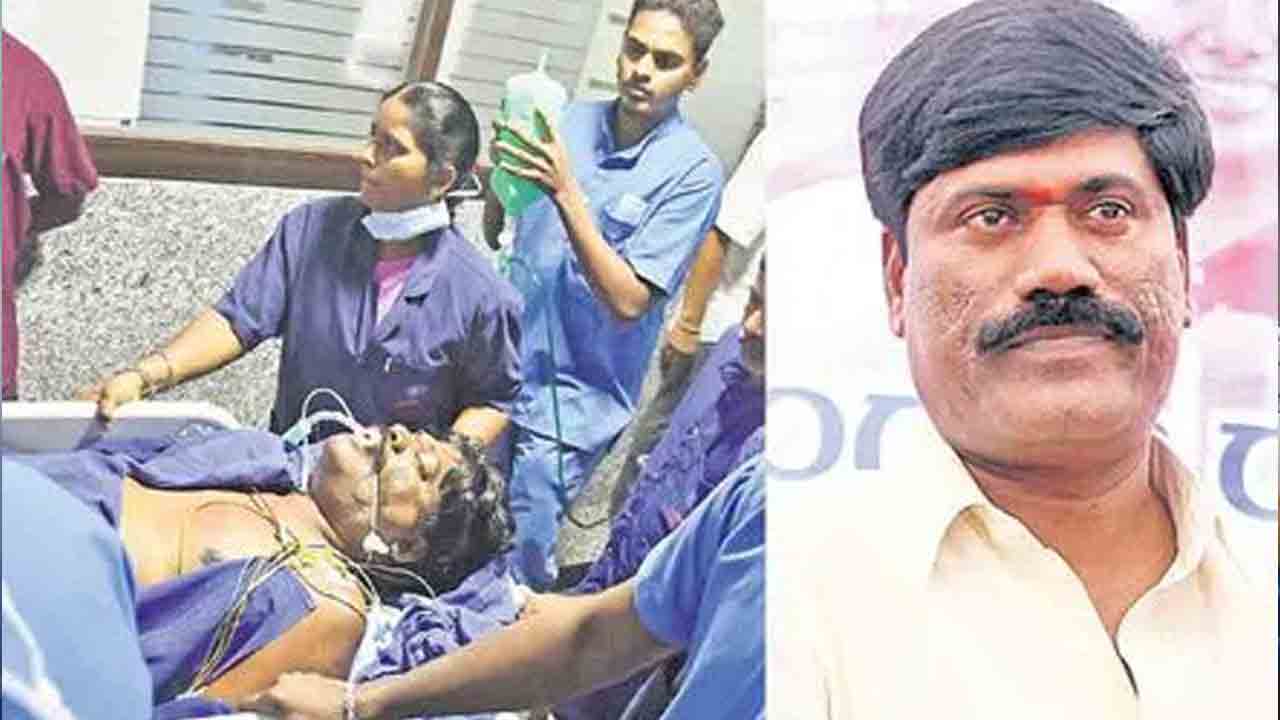 వెంటిలేటర్పైనే మాజీ ఎమ్మెల్యే పెద్ది సుదర్శన్ రెడ్డి: యశోదా ఆస్పత్రి